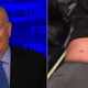 Illustration for article titled Bill O’Reilly has hearty chuckle over bloodied United passenger